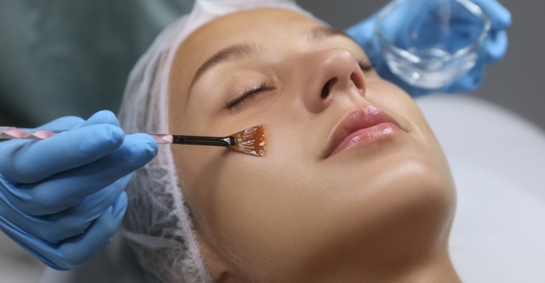 Chemical Peel Treatment in Kondapur