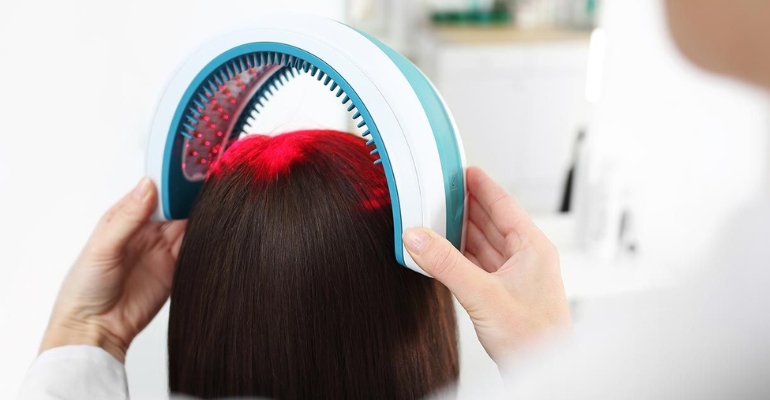 Low-Level Laser Hair Therapy in Kondapur